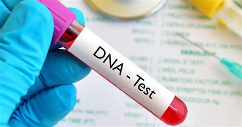 DNA Test .